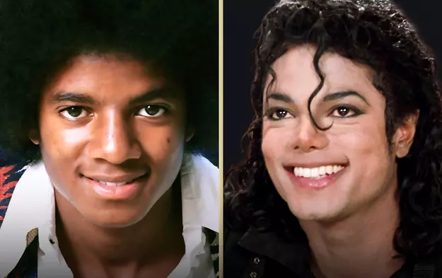 Michael Jackson Before and After